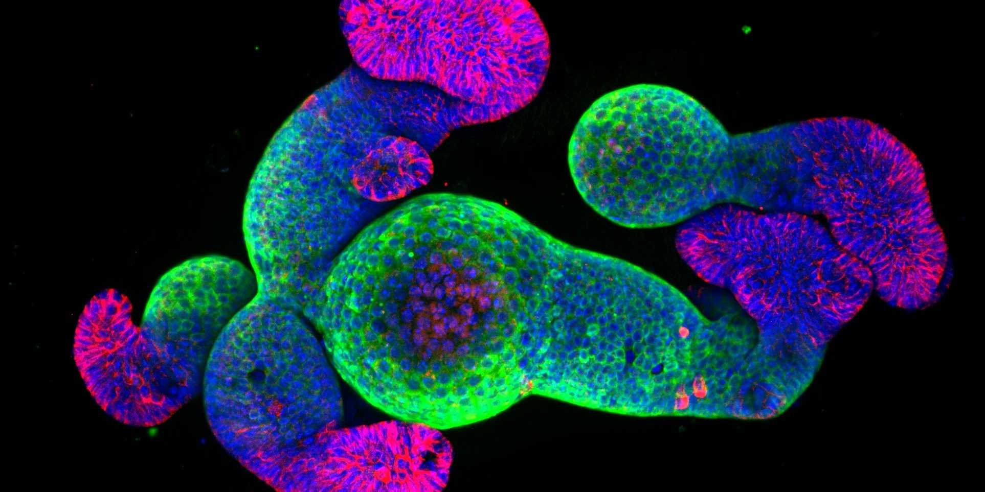 intestine organoid